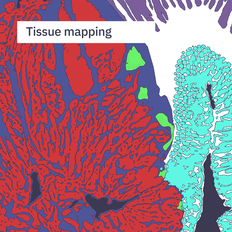New Phenoplex feature