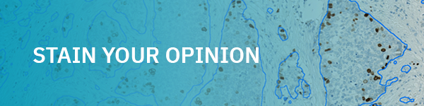 banner-stain-your-opinion-1