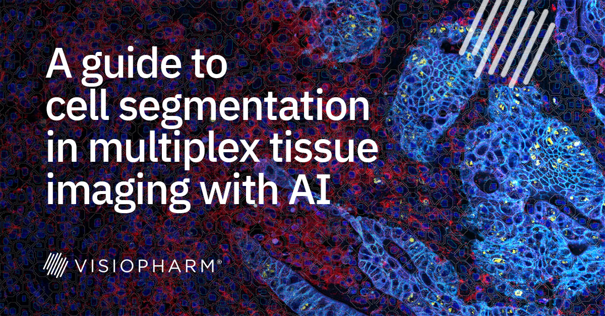A guide to cell segmentation in multiplex tissue imaging with AI.
