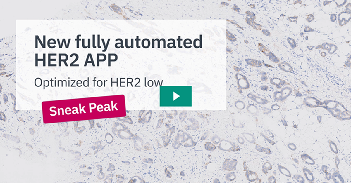Video: HER2 low APP sneak peak