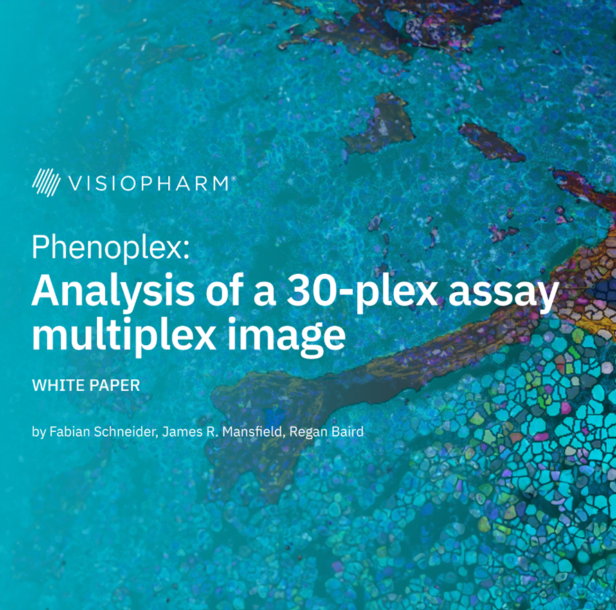 Whitepaper - Phenoplex: Analysis of a 30-plex assay multiplex image
